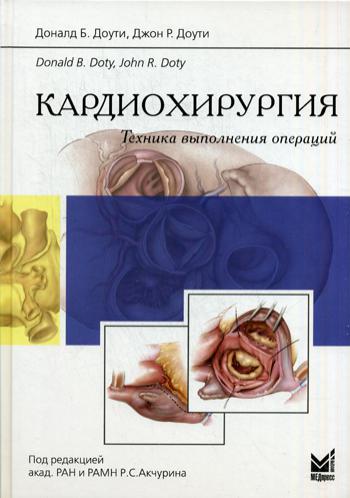 Кардиохирургия. Техника выполнения операций.