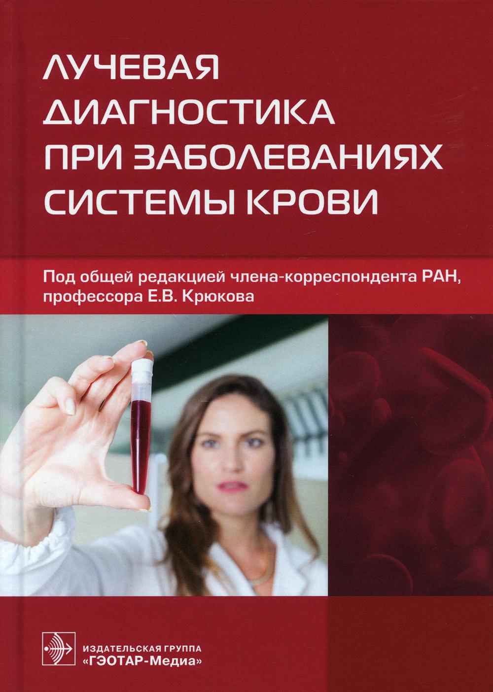 Лучевая диагностика при заболеваниях системы крови