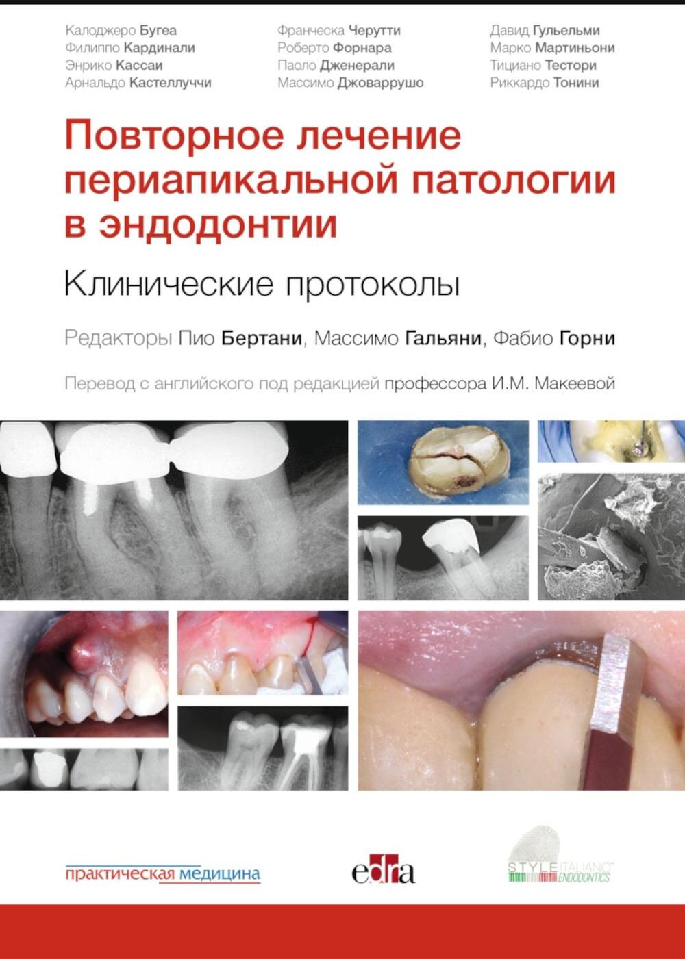 Повторное лечение периапикальной патологии в эндодонтии. Клинические протоколы