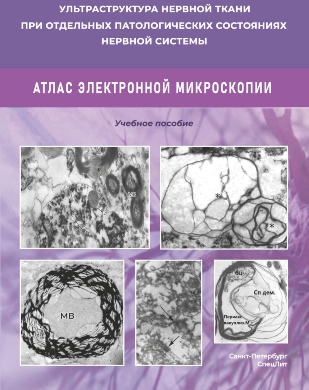 Ультраструктура нервной ткани при отдельных патологических состояниях нервной системы. Атлас  электронной микроскопии: Учебное пособие